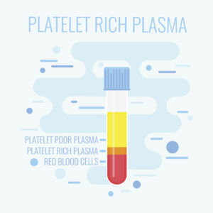PRP Therapy