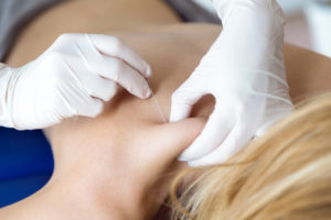 Interventional Pain Management