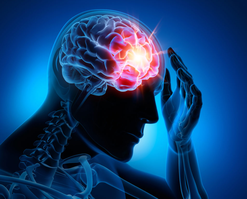 Illustration of a man with a concussion