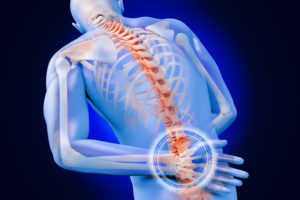 Platelet-Rich Plasma for Thoracic Back Pain