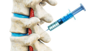 Facet joint injection for backbone injury or pain